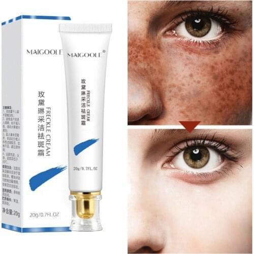 1pc Powerful Whitening Freckle Skin Care Cream Remove Melasma Acne Spot Pigment Melanin Dark Spots Pigmentation Moisturizing Gel