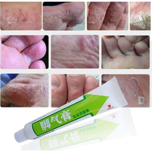Foot Cream Feet Care For Athletes Foot,Blisters,Peeling Feet,Itchy,Erosive Beriberi,Bad Feet,Good Ointment