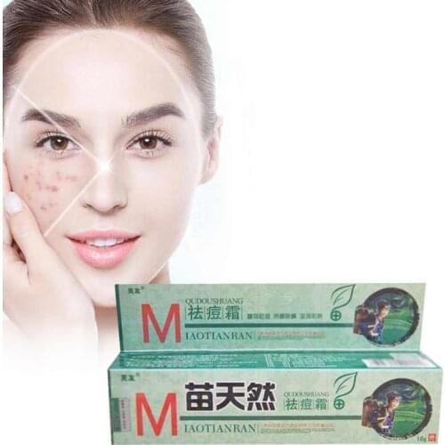 1pcs Remove Acne Cream Germicidal Remove Mite And Moisturize Your Skin ointment