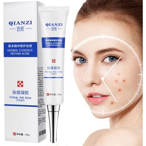 Acne Removal Cream Acne Treatment Blackhead Repair Oil Control Shrink Pores Scars Whitening Moisturizing Acne Cream Skin Care