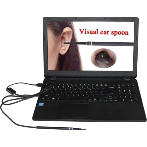 2 Pieces Visual Ear Scoop Ear Borescope 5.5mm Lens 6LED Adjustable 0.3MP