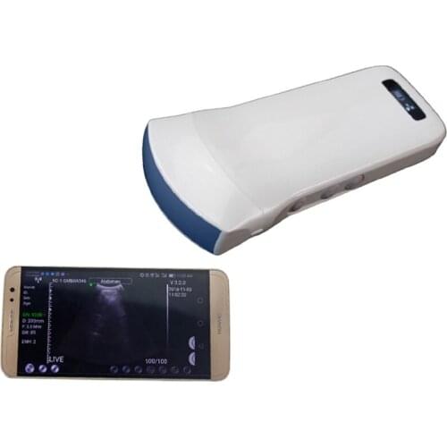 Medical Ultrasound Instruments Wireless Convex,3.5Mhz B/W Portable Ultrasound Scanner
