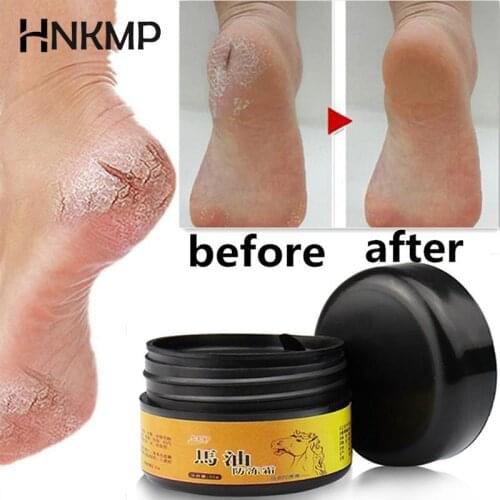 Anti-Chapping Skin Repairing Moisturizer For Rough Dry And Cracked Chapped Feet Heel Useful Horse Oil Foot Cream