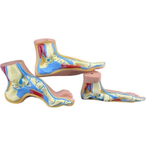Normal foot Arch foot High arch foot model Foot joint model Claw foot Foot anatomical model