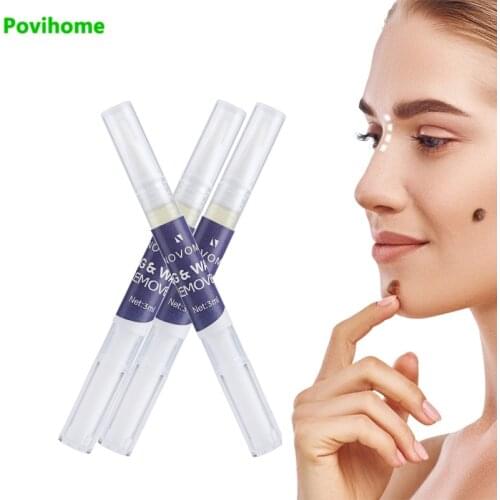 3ML Wart Corn Remover Pen Genital Wart Treatment Papillomas Removal Warts Liquid Skin Tag Foot Corn Skin Health Care C2236