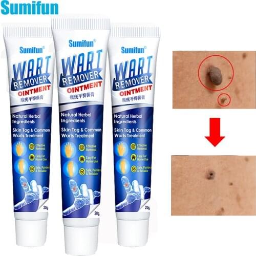 New 3 Pcs Wart Removal Body Warts Treatment Cream Foot Care Cream Skin Tag Remover Foot Corn Removal Plantar Warts Ointmen