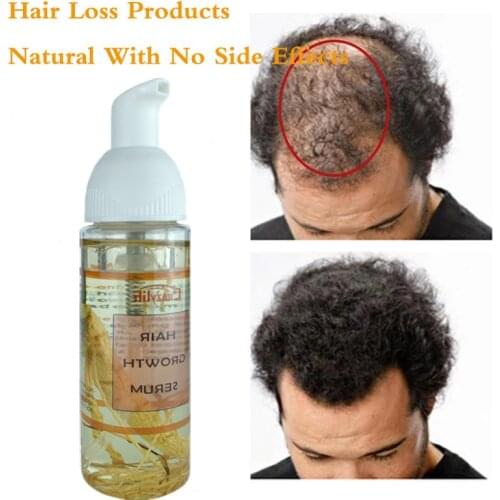 50ML Ginseng Rose Hips Fast Hair Growth Serum Essential Oil Anti Preventing Hair Lose Liquid Damaged Hair Repair Growing