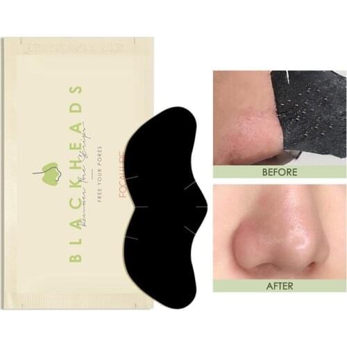 1pcs Nose Blackhead Remover Mask Patch Black Head Removal Strips Treatment Acne Peel Cleasing Masks Tool A2Y3