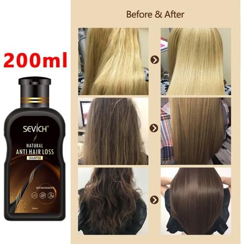 New Hair Loss Treatment Cool Product Ginger Anti Hair Loss Hair Growth Serum Shampoo Effective Hair Growth Liquid Hair Fiber