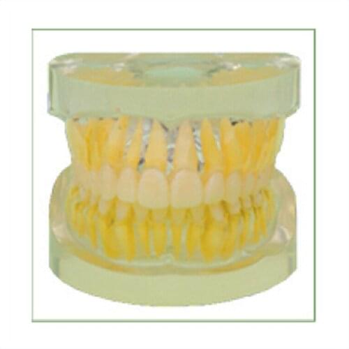 1PC Dental Model Clear Removable Standard Model There are 28pcsteeth ,Hard Gum With complete transparent Study Model