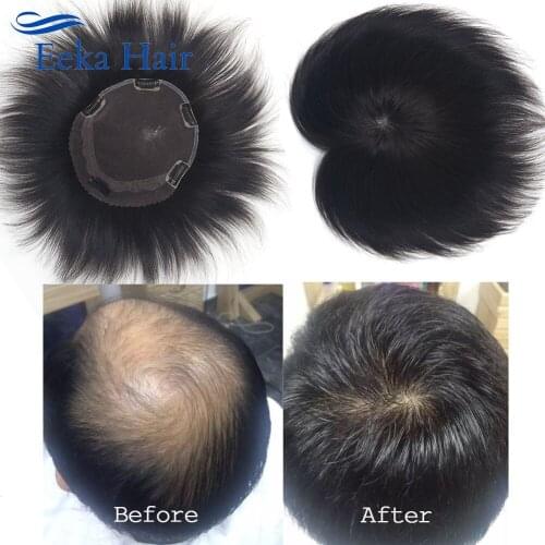 100% Human Hair Topper Clip In On Hair With Bangs Natural Hairline Easy Wear Hairpiece For Thinning Hair A7 9x8cm