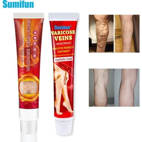 Sumifun 2Type Varicose Veins Treatment Ointment Medical Plaster Analgesic Cream Vasculitis Phlebitis Spider Leg Angiitis RemovaL