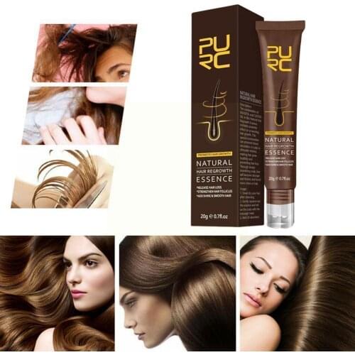 20g Hair Loss Prevention Hair Lotion Hair Growth Nourishes The Of Dense Ampoule Essence High-concentration Roots Massage L1H6