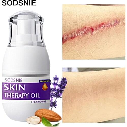 Yoxier Aromatherapy Products