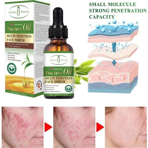 30ml Tea Tree Essence Skin Acne Treatment Essence Acne Remover Oil Control Cleansing Shrink Pores Anti Scar Spots Face Care