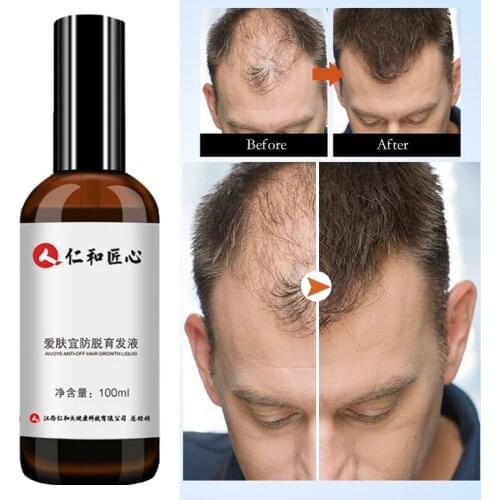100ML Anti Hair Loss Products Hair Growth Spray Essential Oil Liquid for Men Women Growth Essence Serum Hair Care Repair Growing