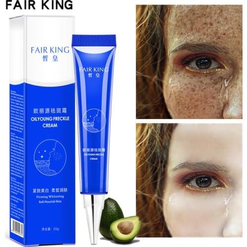 Arbutin Freckles Cream Hyaluronic Acid Removes Freckles Dark Spots Freckle Age Spots Whitening Moisturizing Brighten Face Skin