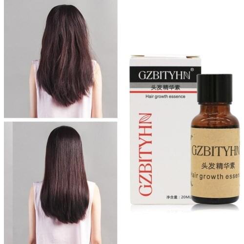 Hair Growth Essence Anti Hair Loss Liquid Dense Discounted Keratin Products Hair Care Hair Hairstyle Price P0C7