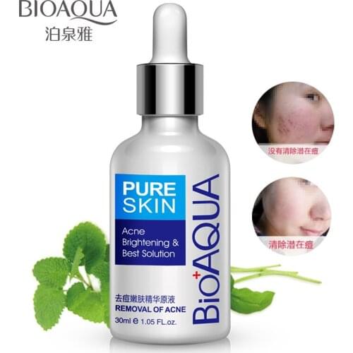 BIOAQUA Essence Acne Treatment Blackhead Remove Whitening Anti Acne Cream Oil Control Shrink Pores Remove Acne Scar Face Care