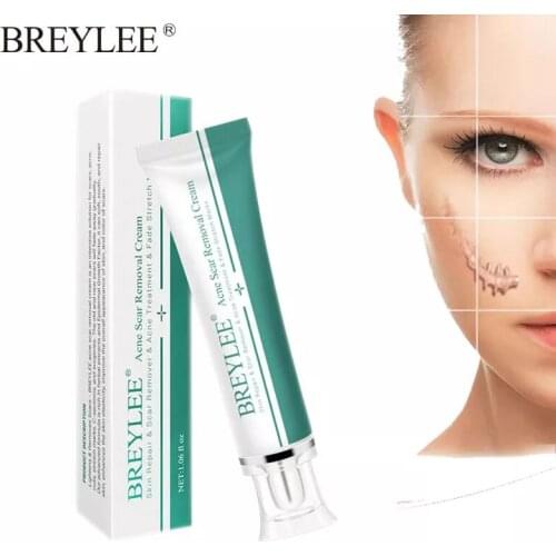 BREYLEE Acne Scar Removal Cream Acne Treatment Remove Stretch Marks Whitening Moisturizing Body Face Gel Repair Skin Care Scar