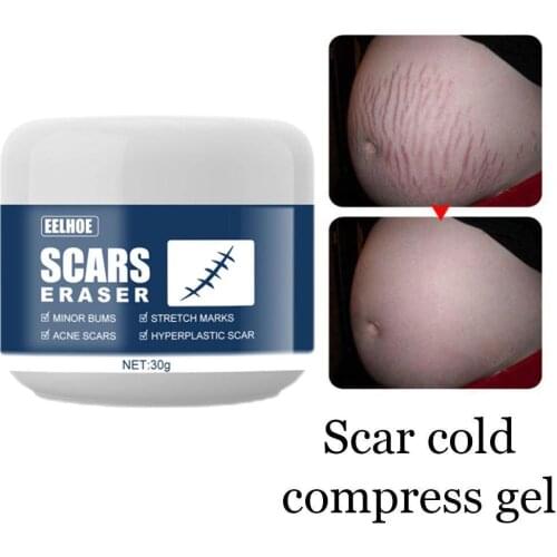 30g Scar Cold Compress Gel Anti-inflammatory Anti-bacterial Nourishing Scars Acne Remove Cream Skin Rejuvenation Skin Care