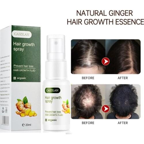 Средства от выпадения волос FOCALLURE China At AliExpress