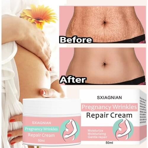 MLINYNILO Cream For Stretch Marks