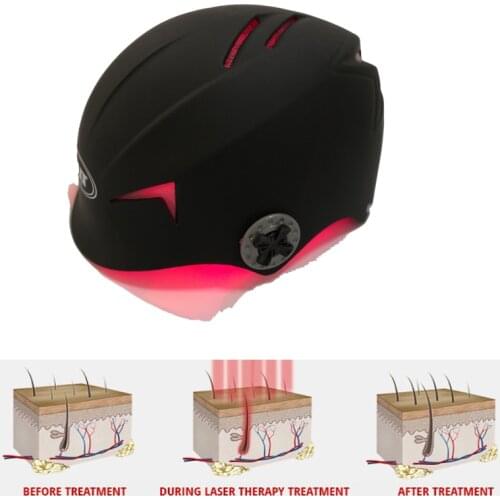 US EU PLUG usb laser bald hair loss massage LLLT therapy cap