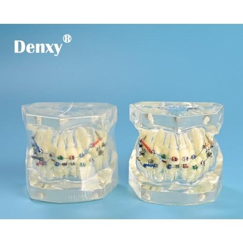 Denxy 1 pc clear color Dental Model Teeth Dental Instruction Orthodontic teeth Model with Metal Orthodontic Bracket Color Tie