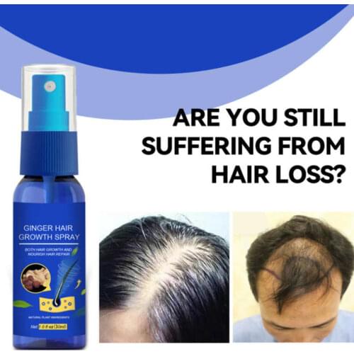 Масла для роста волос TMISHION China At AliExpress