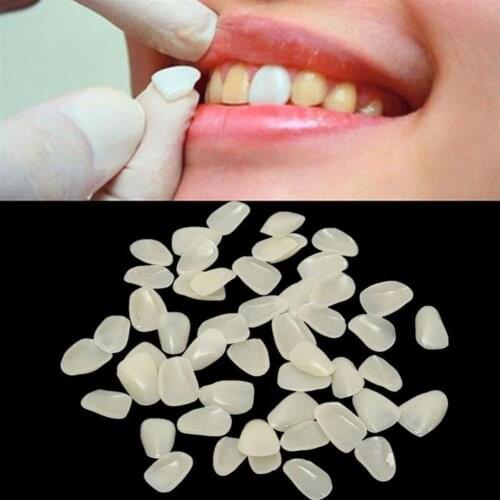 70PCS Dental Ultra-Thin Whitening Veneers Resin Porcelain Materials Temporary Teeth Upper Anterior Whitening Dental Film