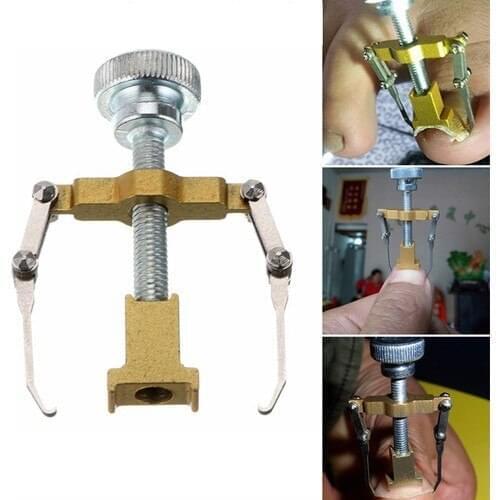 Professional ingrown nail correction apparatus - wildlebend male female uses, manicure pedicure Hand Foot body care ingrown