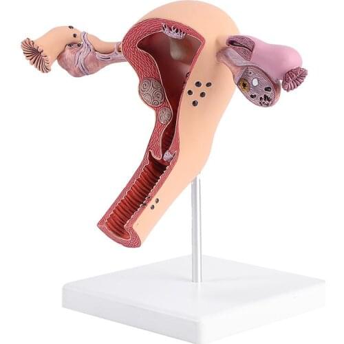 1Pc Practical Uterus Model Female Reproductive System Model For Medical Training Human Uterus Model Teaching Model