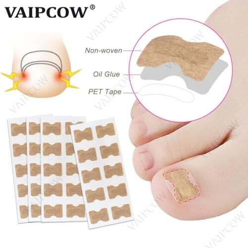 10PCS Ingrown Toenail Corrector Stickers Paronychia Treatment Recover Corrector Pedicure Tool Fingernail Toe Nail Care