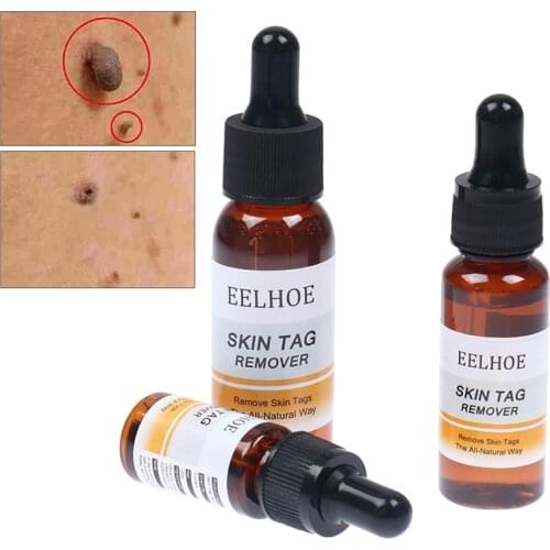 10/20/30ml Skin Tag Remover Mole Foot Corn Wart Care Treatment Pure Acid Essence 100% Essence Hyaluronic Serum Natural Oil