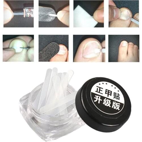 10pcs Ingrown Toenail Corrector Stickers Pedicure Tool Patch Correction