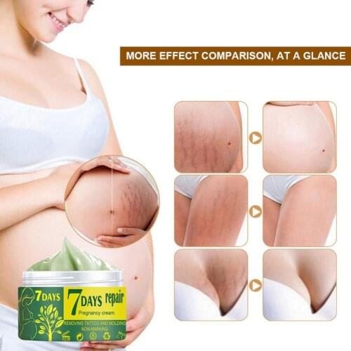 80% Hot Sale Pregnancy Repair Cream Stretch Removal Easy to Absorb Natural Extracts Skin Scar Remove Cream for Mother
