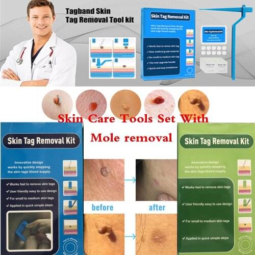 Skin Tag Remover Device with Cleansing Swabs Adult Mole Wart Face Care Skin Care Tools Set Skin Tag Non Toxic Face Care Mole