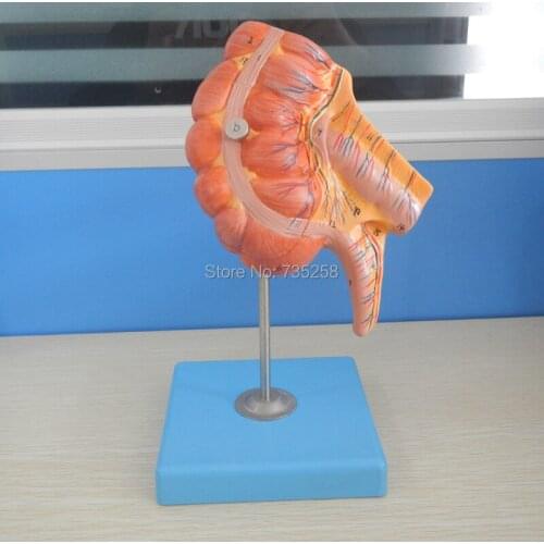 Human Body Appendix and Caecum,Appendix Model,Caecum Model