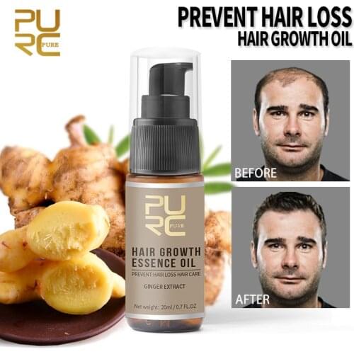 Hot Sale Fast Hair Growth Essence Oil Prevent Hair Loss Spray Treatment Repair For Hair Growth Hair Care TSLM2