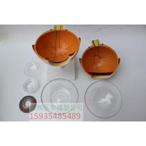 6X eyeball enlargement anatomical model eye magnification eyeball teaching model 6 parts