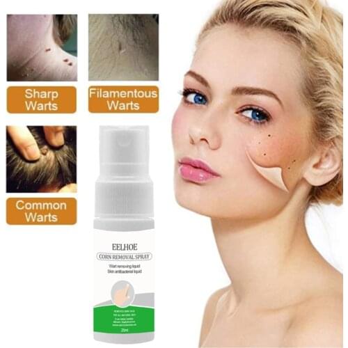 20ML Skin Tag Remover Genital Wart Treatment Removal Mole & Papillomas Foot Corn Medical Repair Tool Bacteriostatic Liquid TSLM1