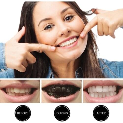KWOEE Teeth Whitening Charcoal