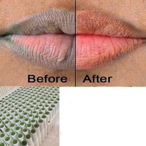 Lip care Of Lips Pink Fresh Lightening Bleaching Cream Treatment Remove Dark Smoke Lips lip oil Plumper Gloss Reduce Lip Fine