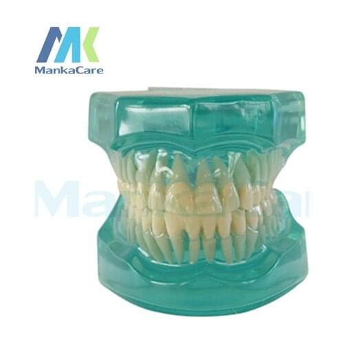 Manka Care - 28 pcs Tooth, Clear Model Without bracket Oral Model Teeth Tooth Model