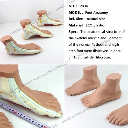CMAM/12034 Normal, Flat, Arched Foot, 3in1, Plastic Human Body Muscle Teaching Anatomical Model