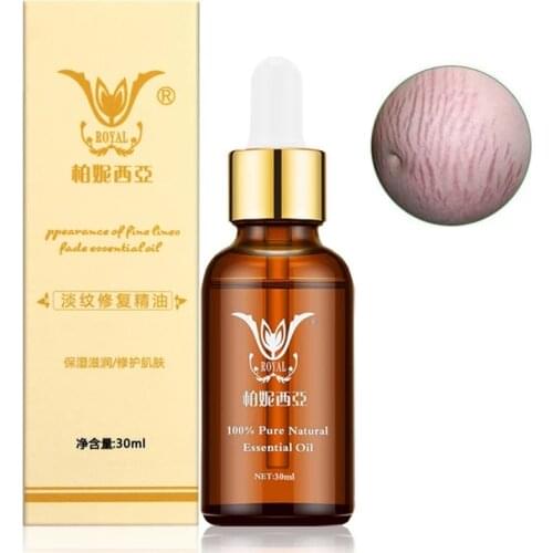 Remove Stretch Marks Oil Repair Serum Postpartum Lines Fat Pattern Moisturizing Anti-Wrinkle Nourishing Body Skin Care 30ml