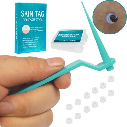 Micro skin tag remover Rubber bands for micro Skin tag wart Remove Acne remover Treatments Face Skin Care Good Tools