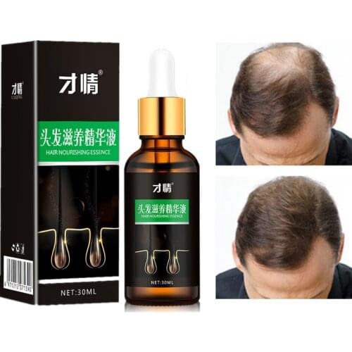 CAIQING Hair Growth Essence Fast Powerful Hair Growth Essential Oil Hair Loss Treatment Help For hair Growth Hair Care