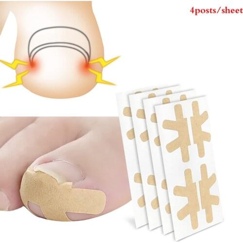 1 Sheet Ingrown Toenail Corrector Sticker Paronychia Treatment Fixer Recover Corrector Bunion Pedicure Foot Toe Nail Care Tool